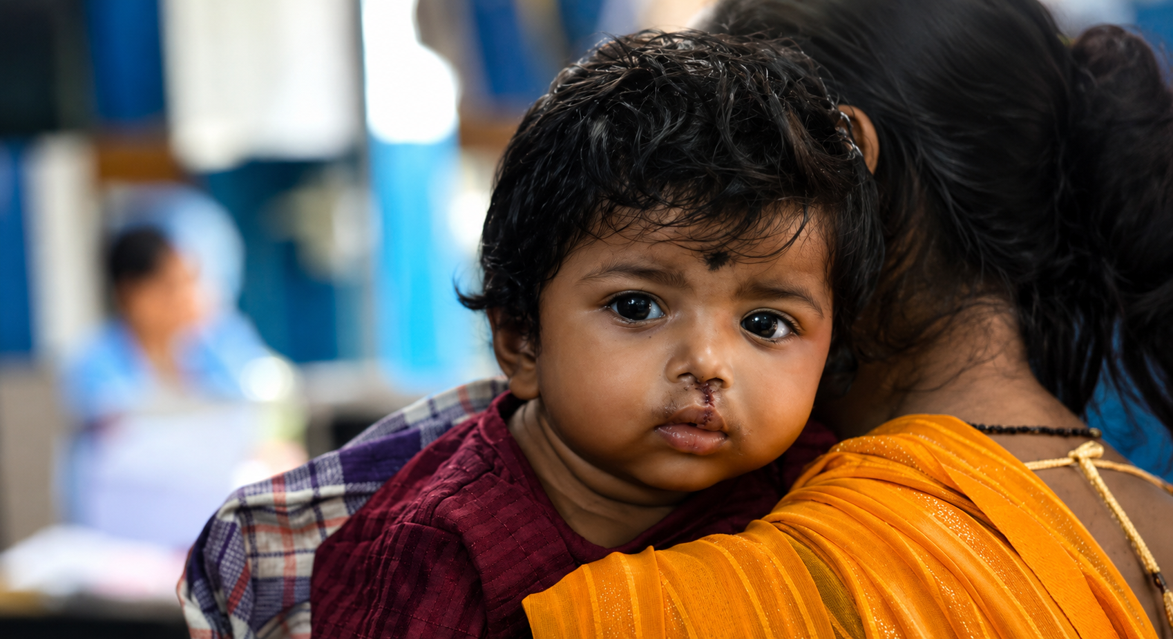 Close-up of a young South Asian child looking at the camera while being held by a woman in an orange saree, showing visible surgical stitches from a recent cleft lip repair.