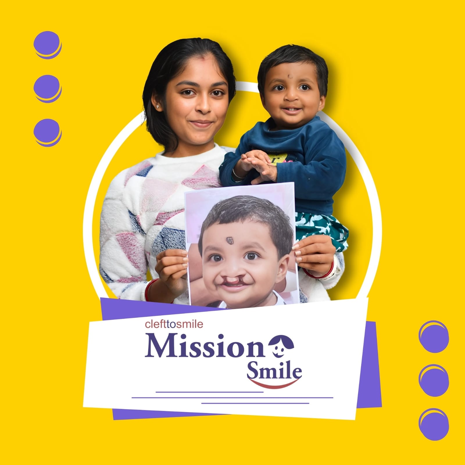 Cleft to Smile: Mission Smile
