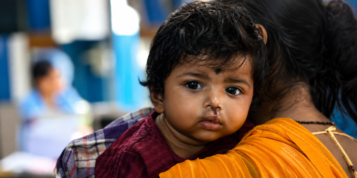 Close-up of a young South Asian child looking at the camera while being held by a woman in an orange saree, showing visible surgical stitches from a recent cleft lip repair.